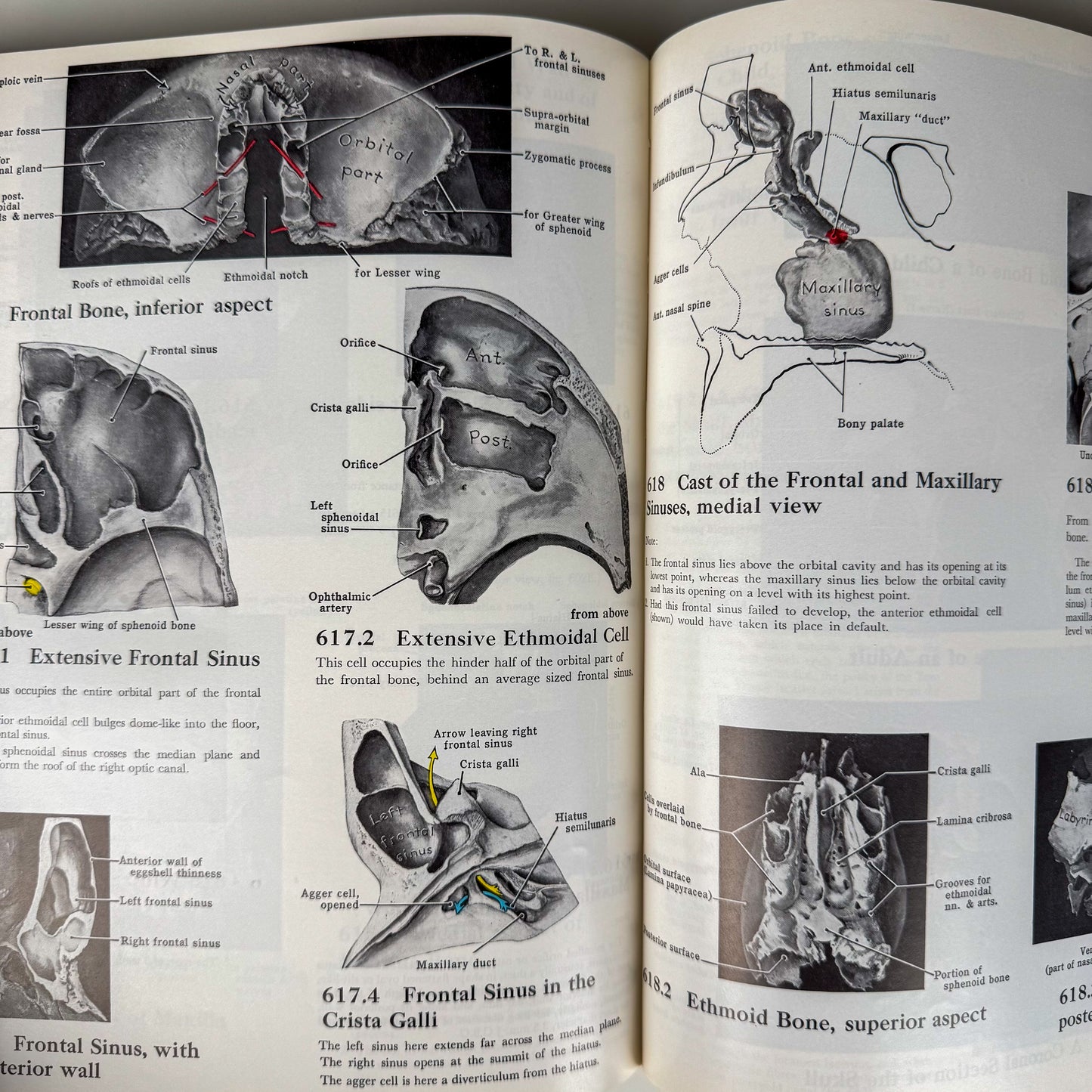 Grant's Atlas of Anatomy, 6th Edition, 1975 Illustrated Hardcover