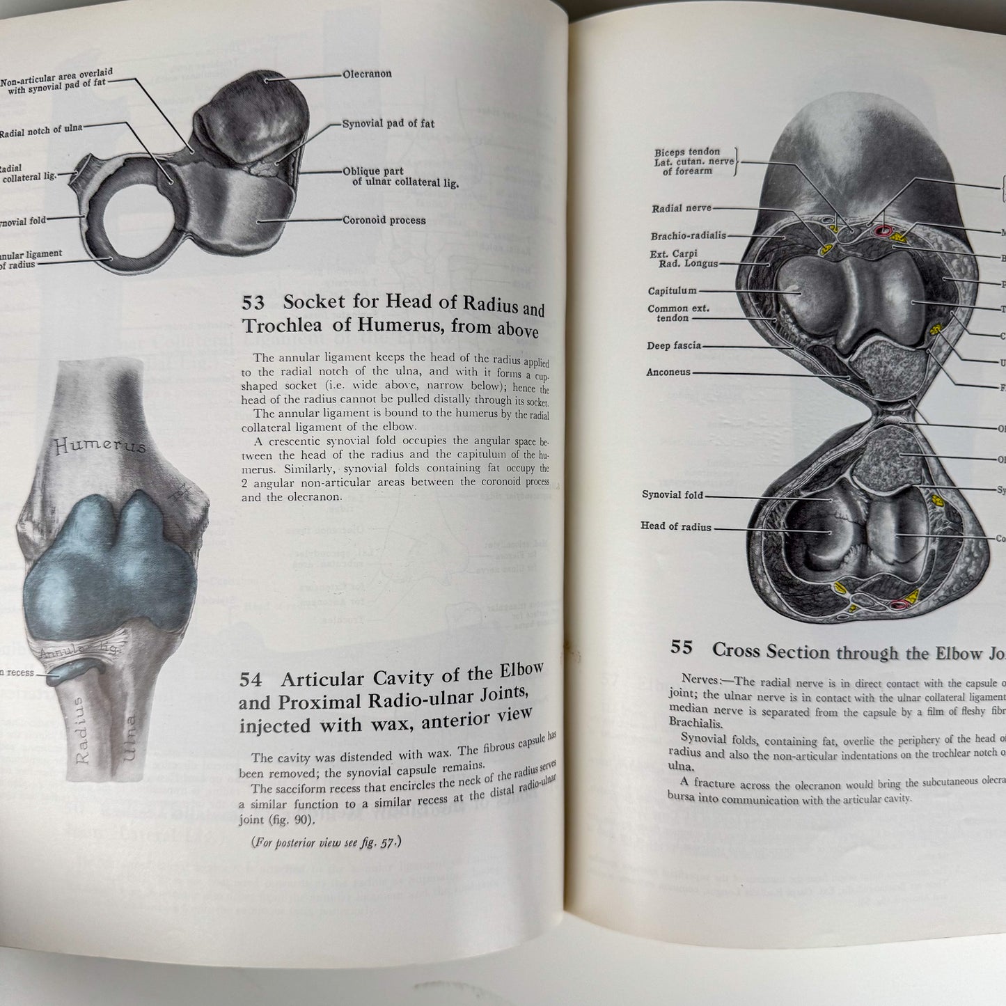 Grant's Atlas of Anatomy, 6th Edition, 1975 Illustrated Hardcover