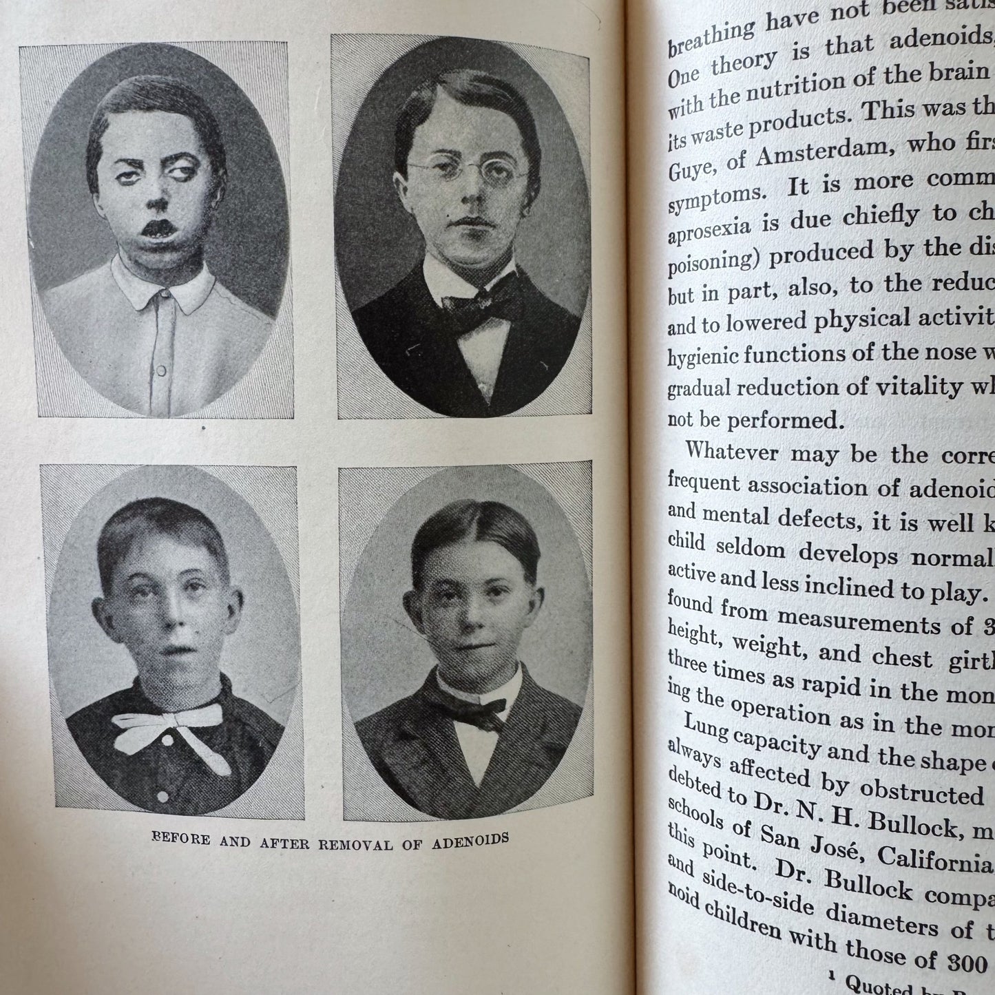 The Hygiene of the School Child, 1914 Illustrated Teacher's Guide to Health - Pretty Old Books