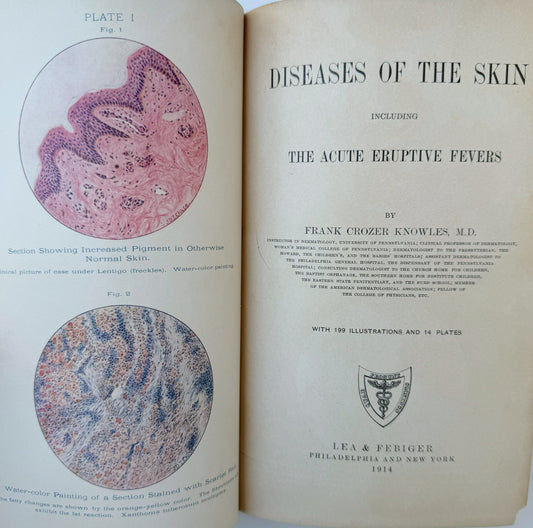 Diseases of the Skin, Antique Medical School Textbook, 1914, Frank Knowles