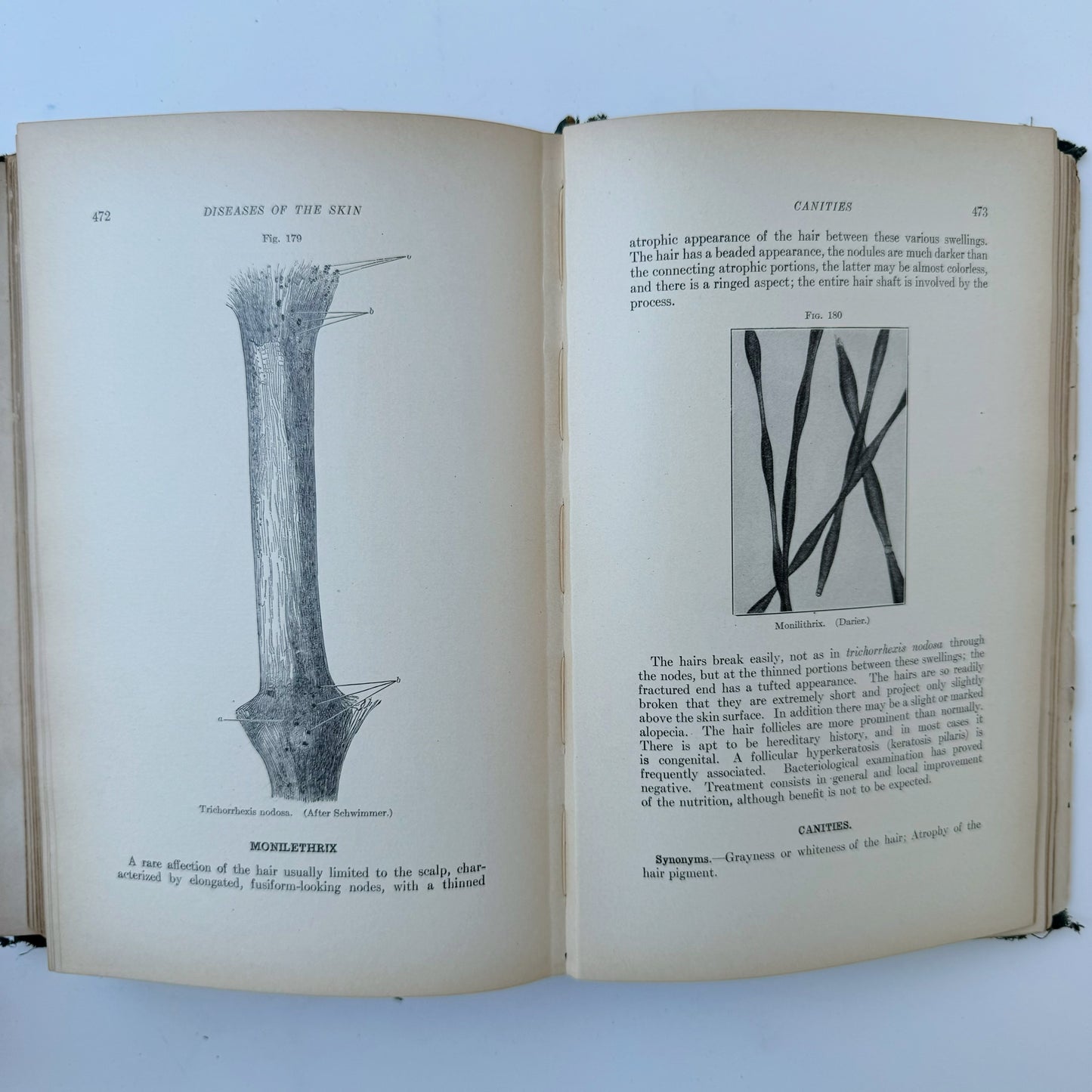 Diseases of the Skin, Antique Medical School Textbook, 1914, Frank Knowles