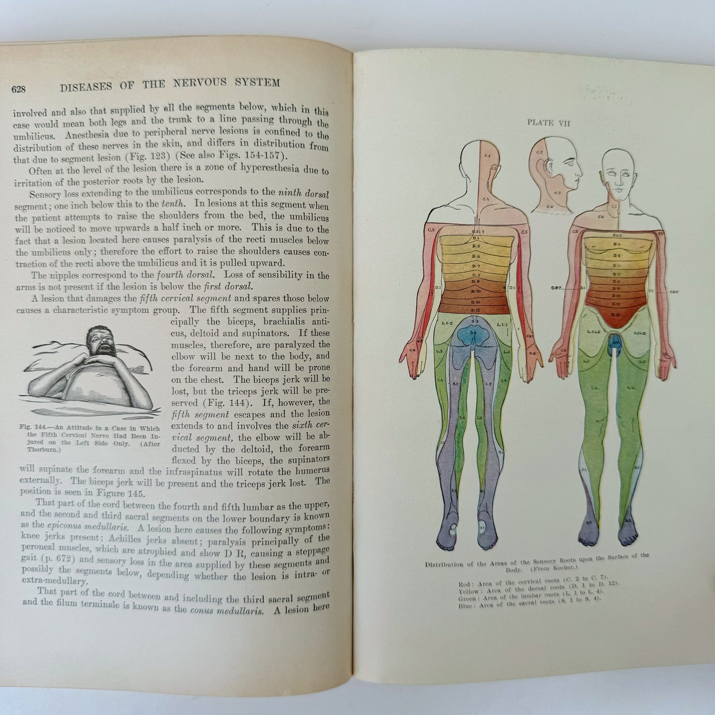 Monographic Medicine Volume V, 1916 Medical Textbook, Illustrated