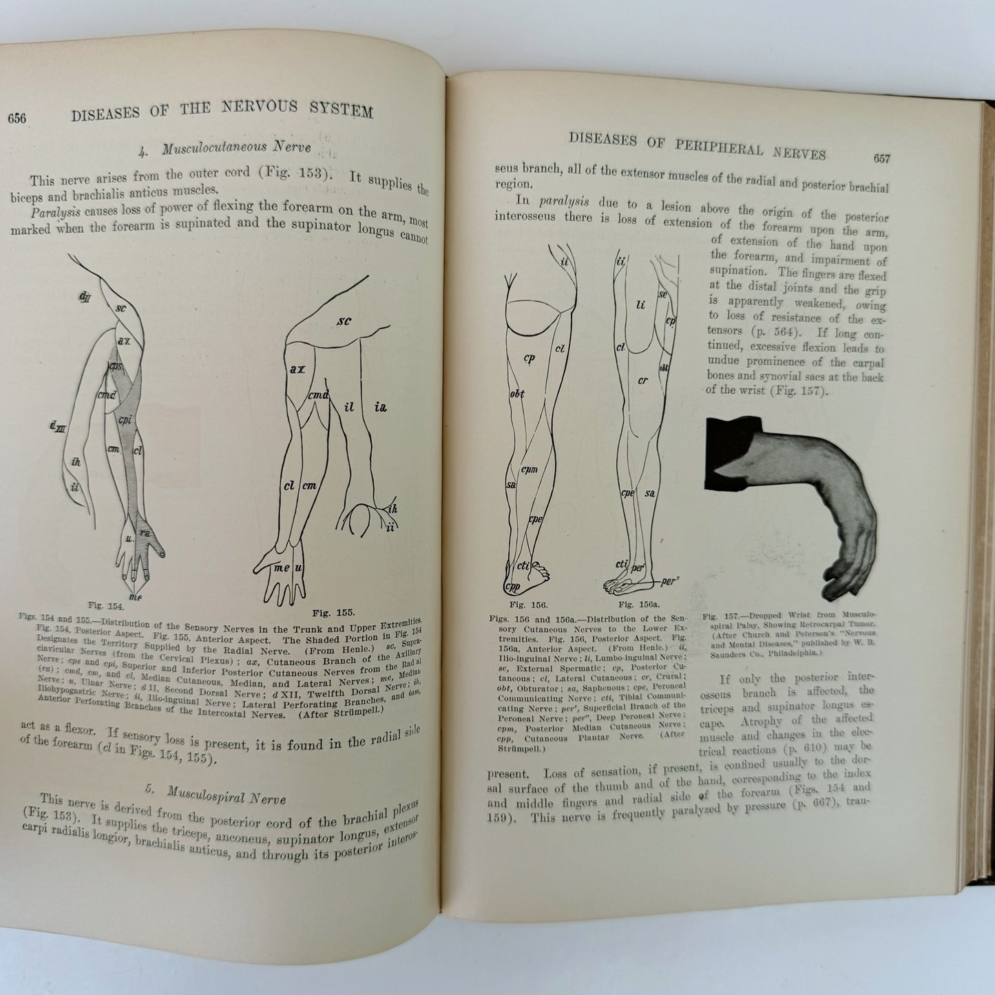 Monographic Medicine Volume V, 1916 Medical Textbook, Illustrated