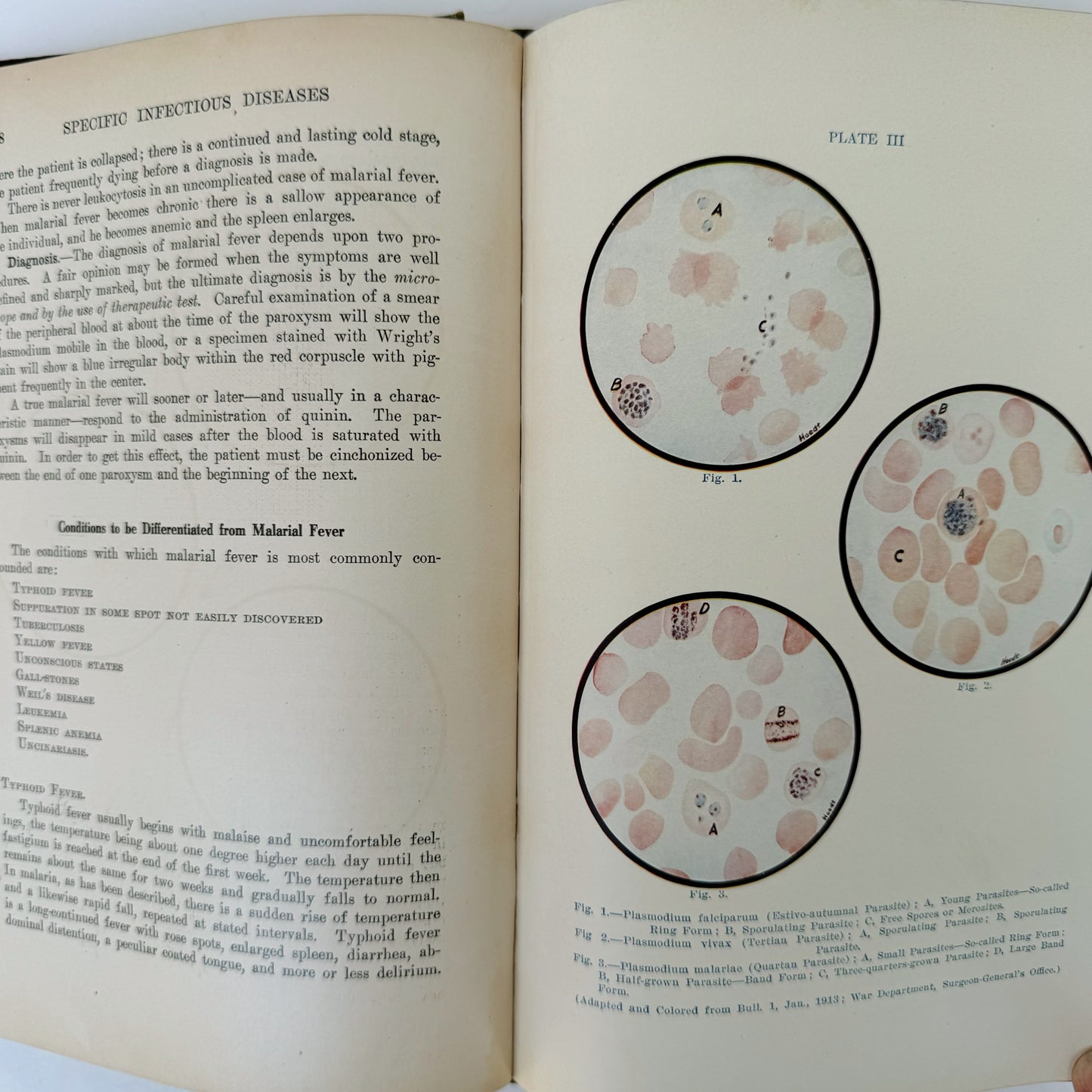 Monographic Medicine Volume V, 1916 Medical Textbook, Illustrated