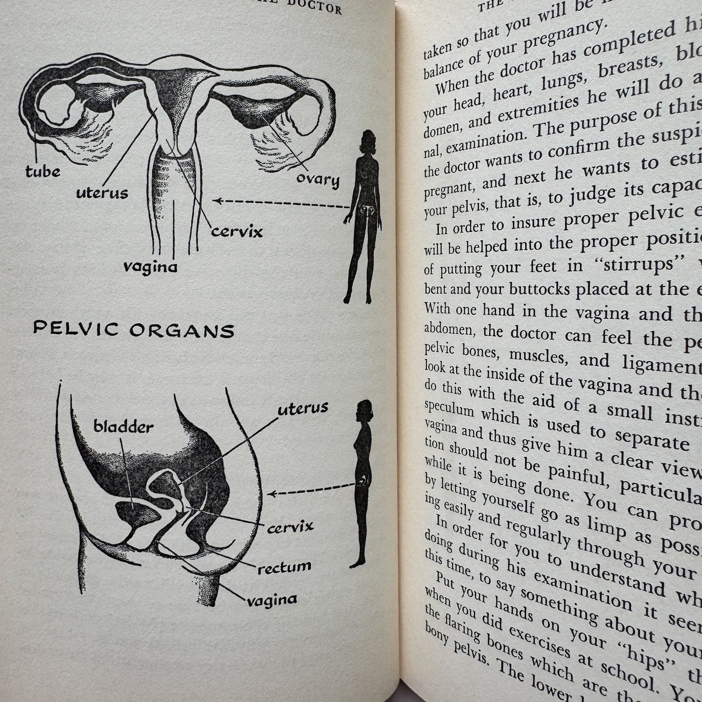 Open book with illustrations of pelvic organs and text on a white background