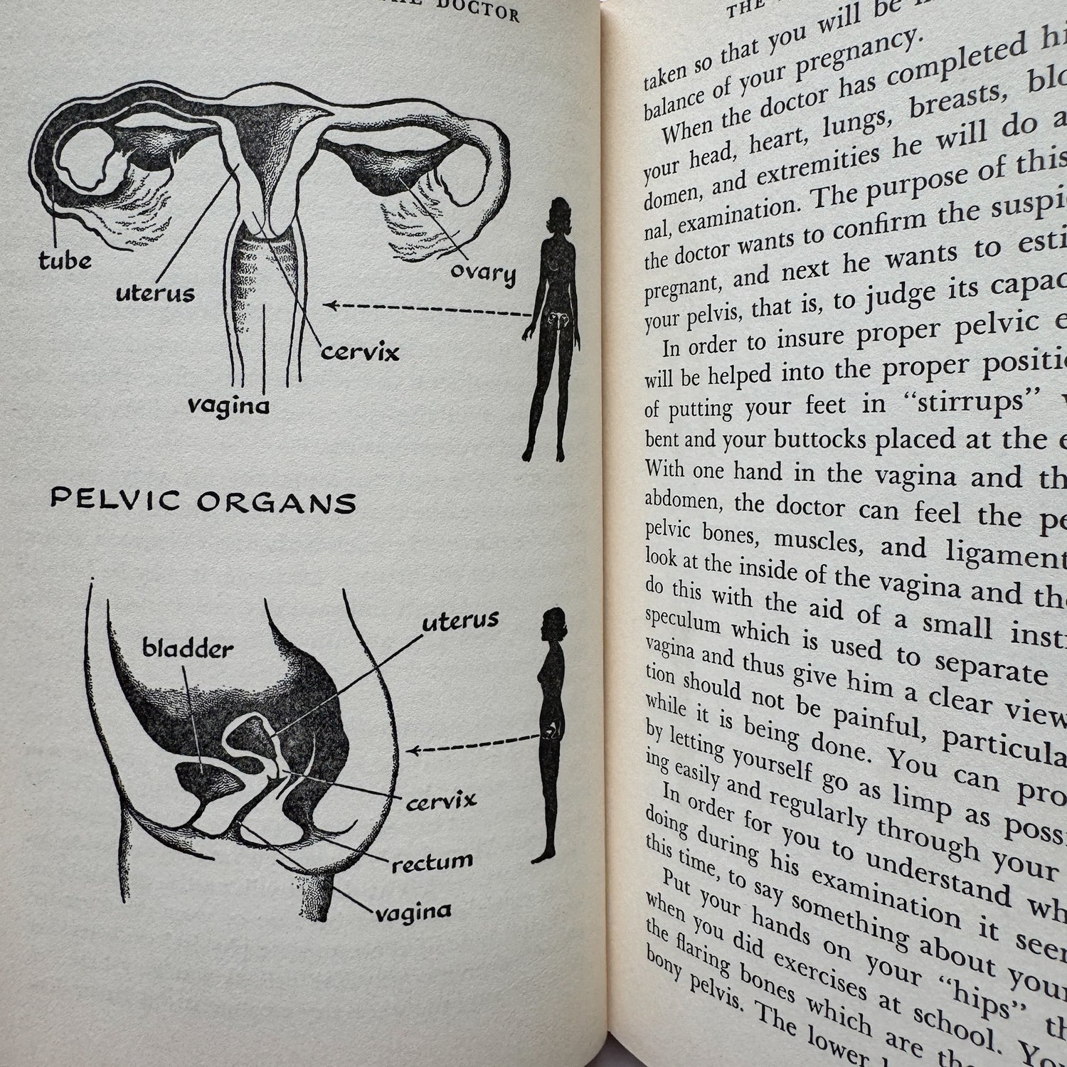Open book with illustrations of pelvic organs and text on a white background
