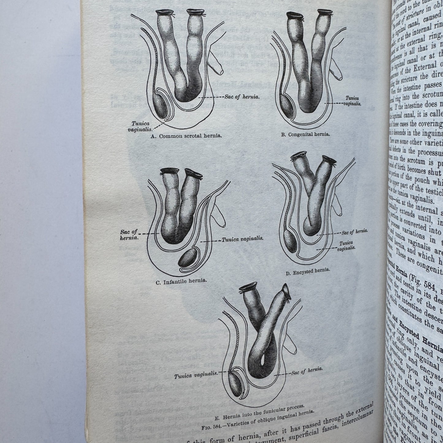Gray's Anatomy, Descriptive and Surgical, 1974 Reprint of 1901 Edition