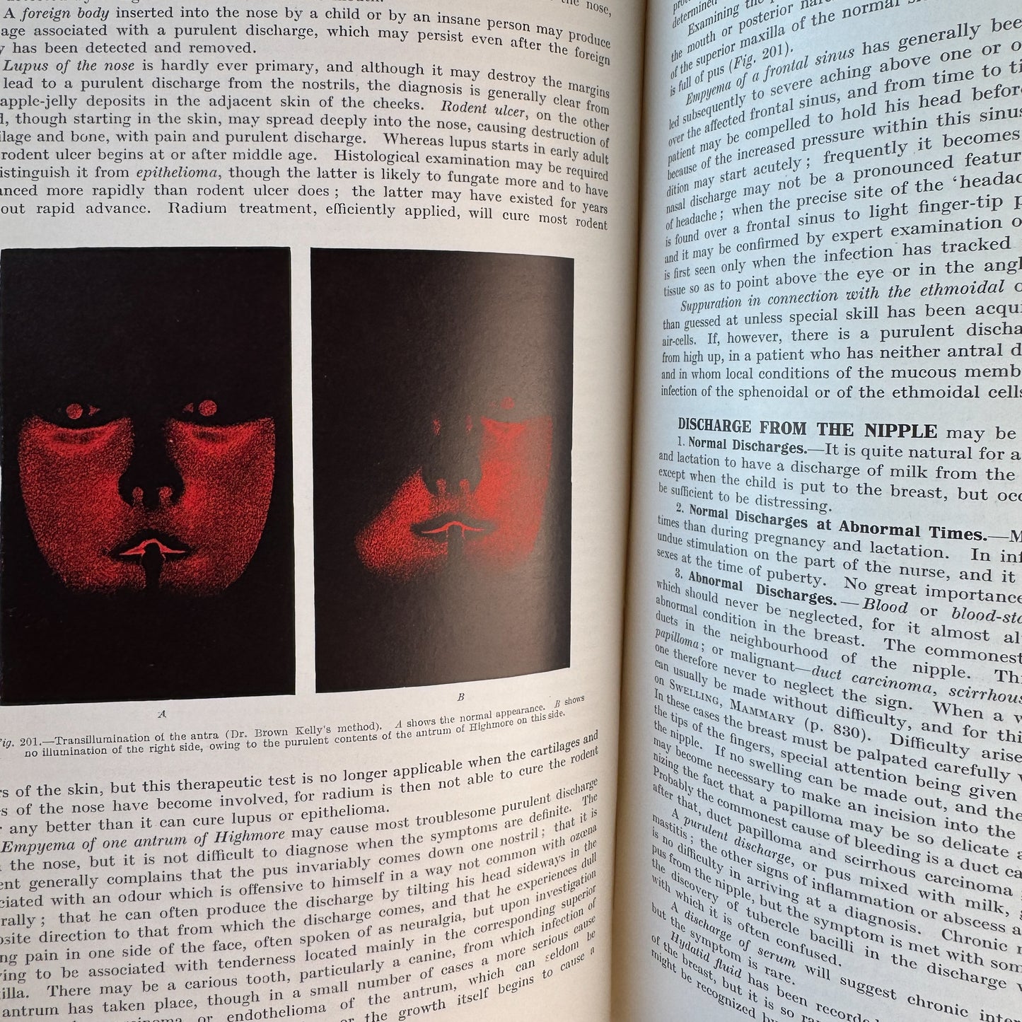 An Index of Differential Diagnosis of Main Symptoms, 1936
