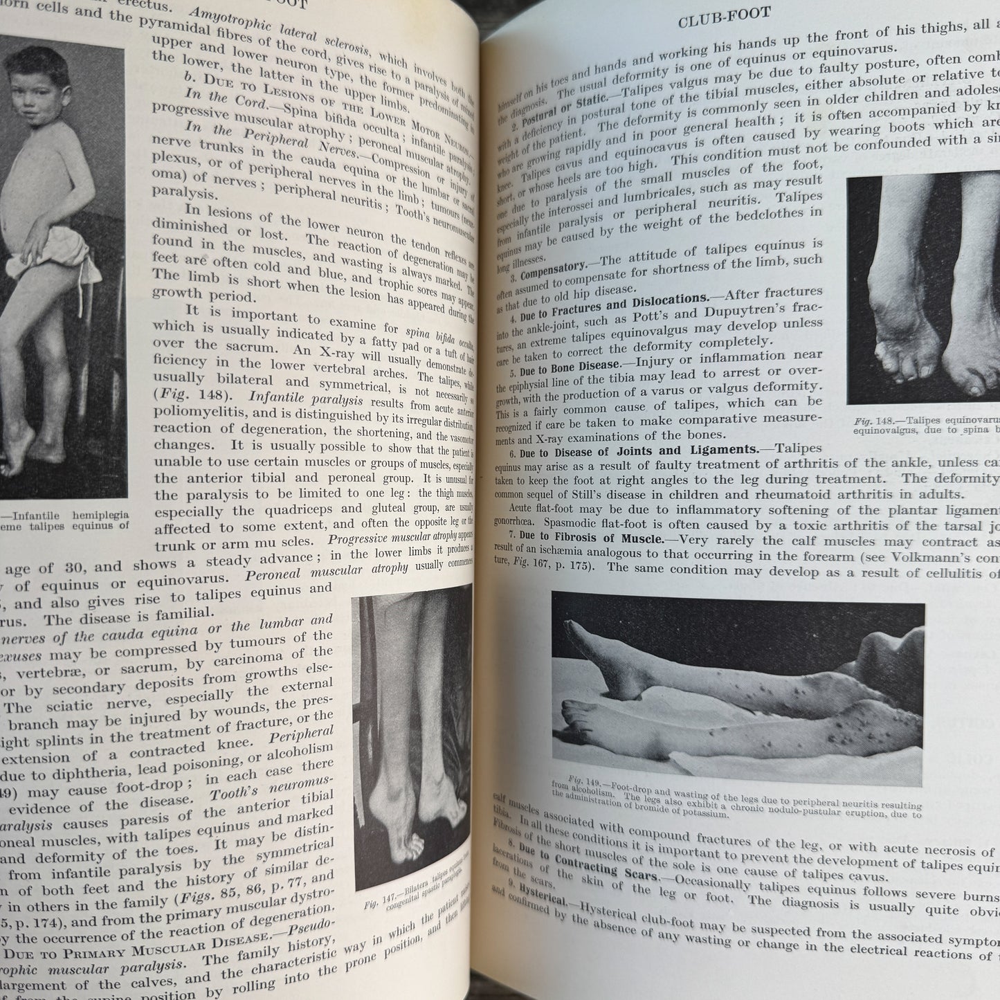 An Index of Differential Diagnosis of Main Symptoms, 1936