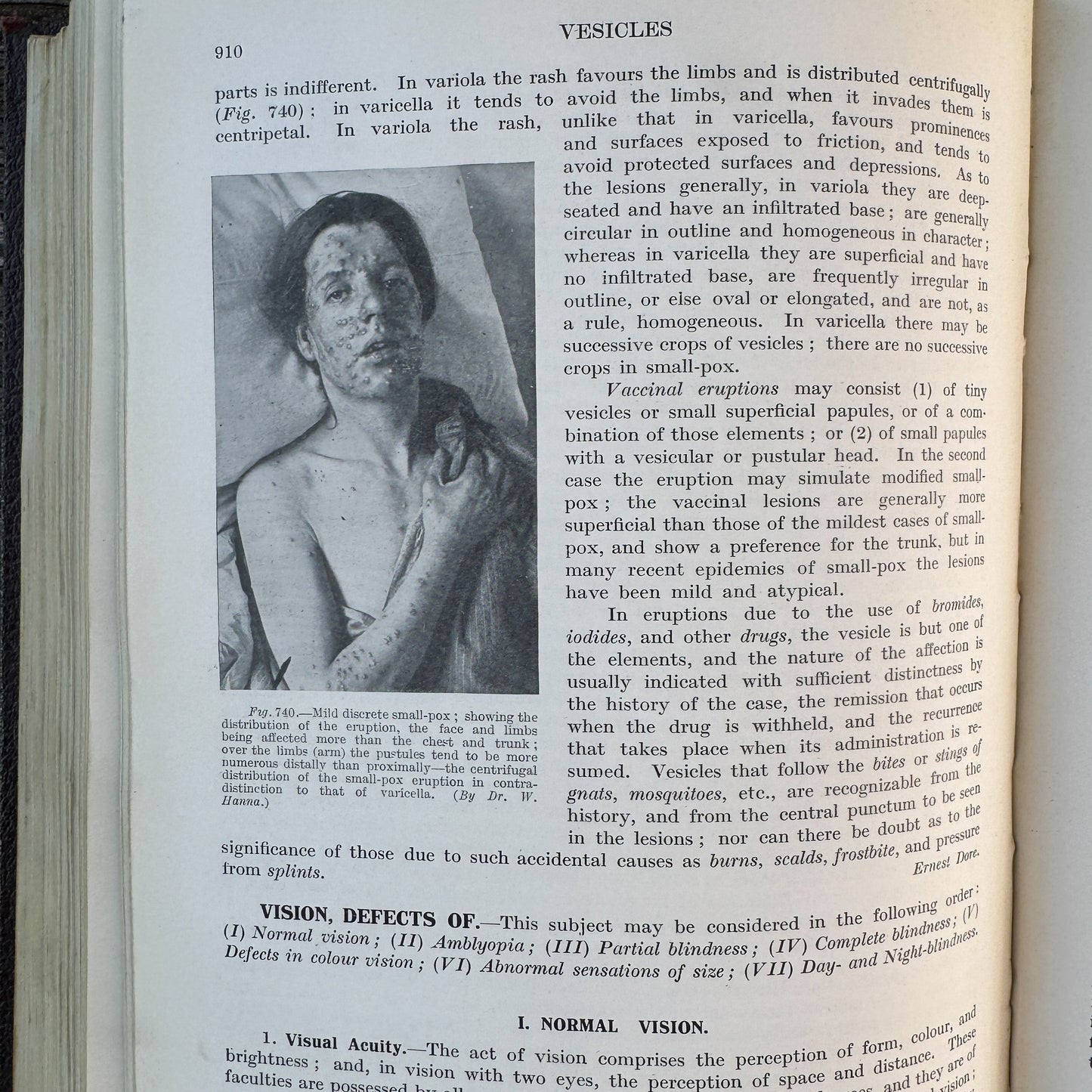 An Index of Differential Diagnosis of Main Symptoms, 1936