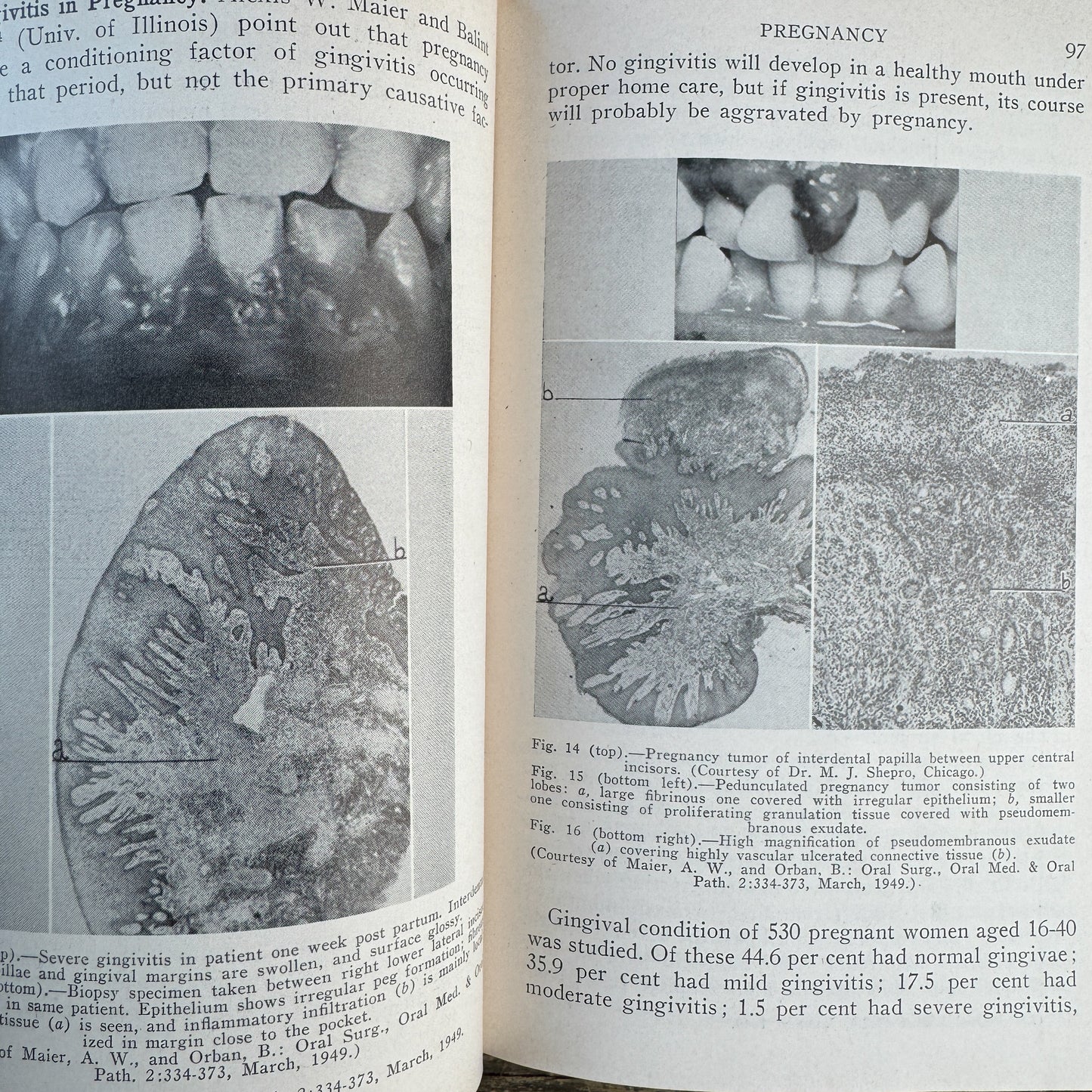 The 1949 Year Book of Obstetrics and Gynecology