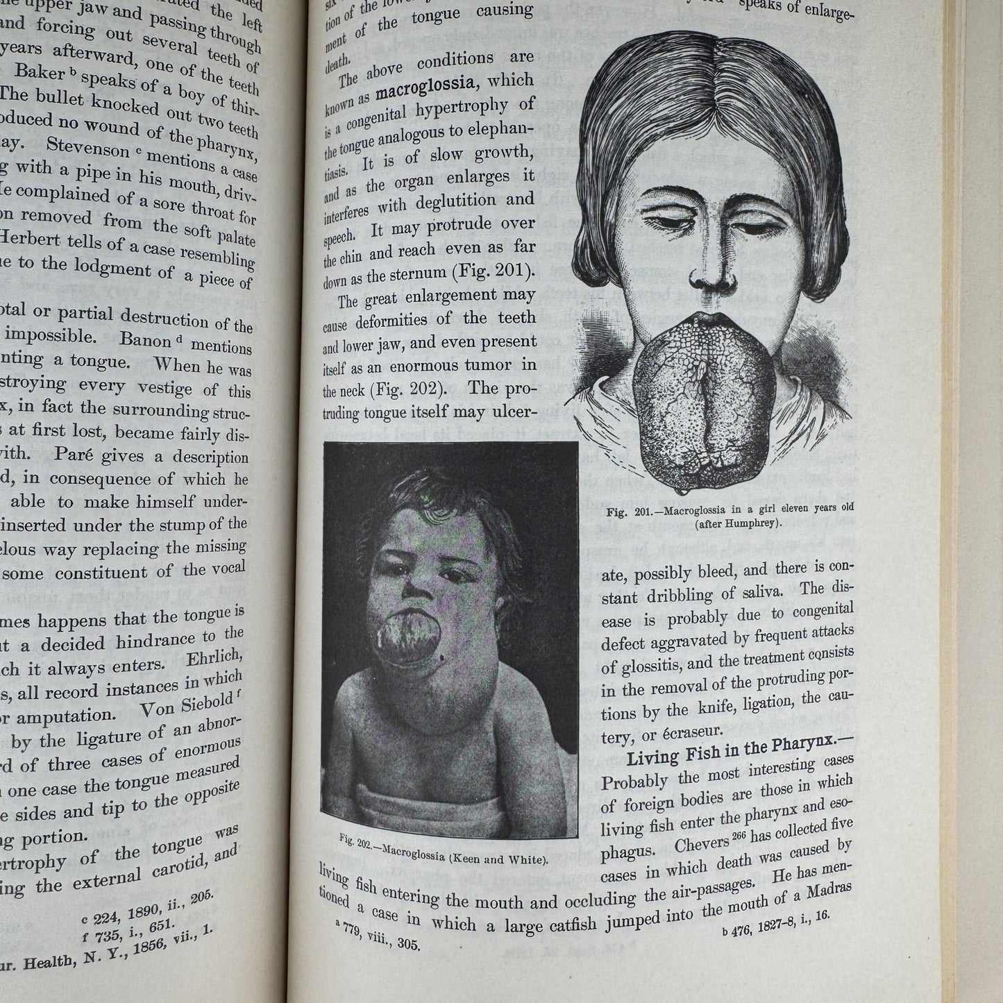 Anomalies and Curiosities of Medicine, 1956, Illustrated - Pretty Old Books