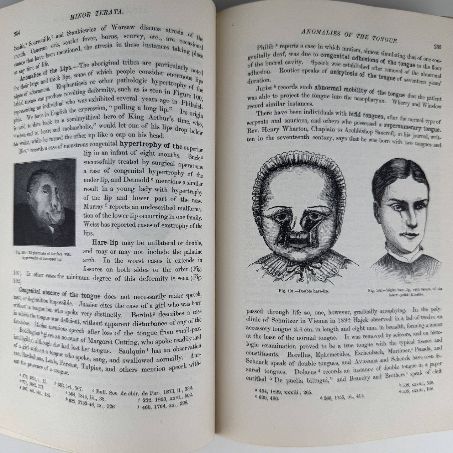 Anomalies and Curiosities of Medicine, 1956, Illustrated - Pretty Old Books