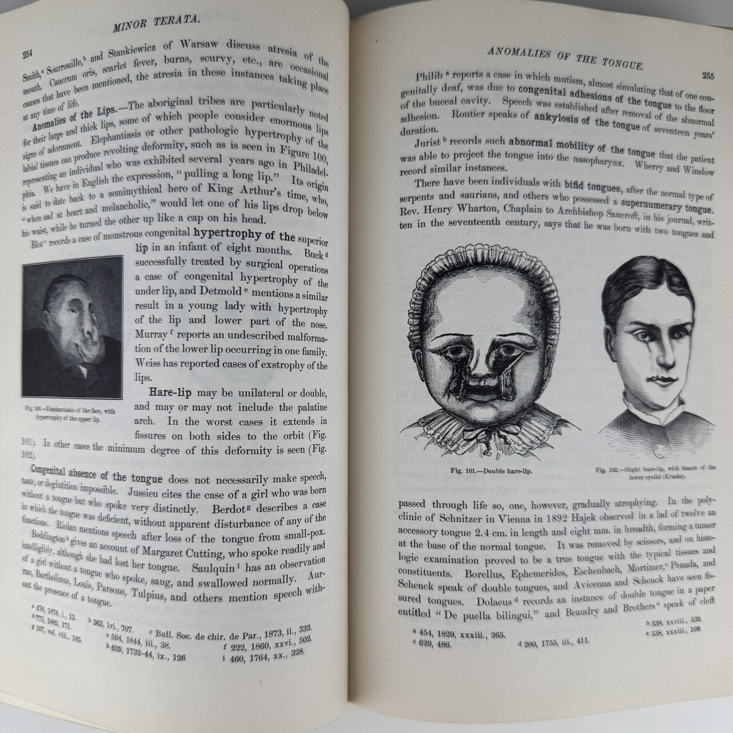 Anomalies and Curiosities of Medicine, 1956, Illustrated - Pretty Old Books