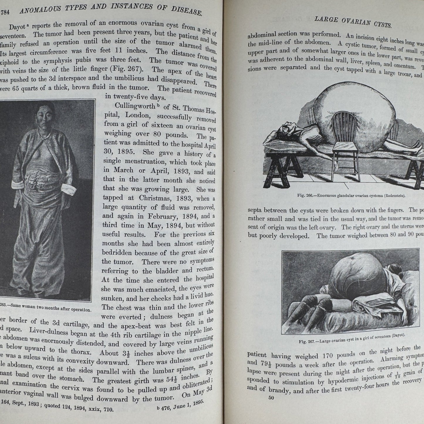 Anomalies and Curiosities of Medicine, 1956, Illustrated - Pretty Old Books
