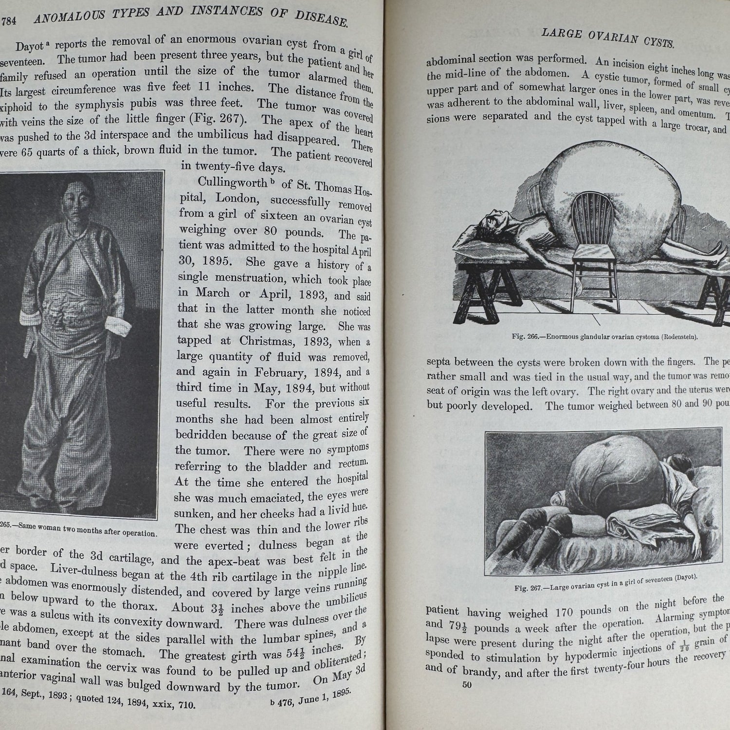 Anomalies and Curiosities of Medicine, 1956, Illustrated - Pretty Old Books