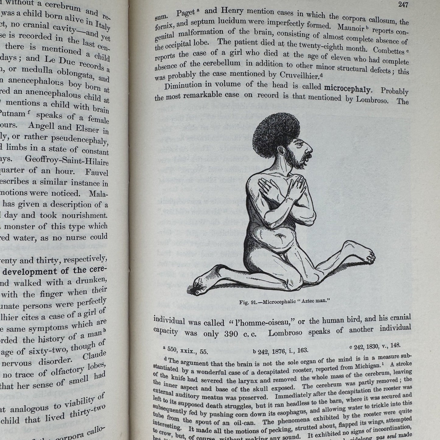 Anomalies and Curiosities of Medicine, 1956, Illustrated - Pretty Old Books
