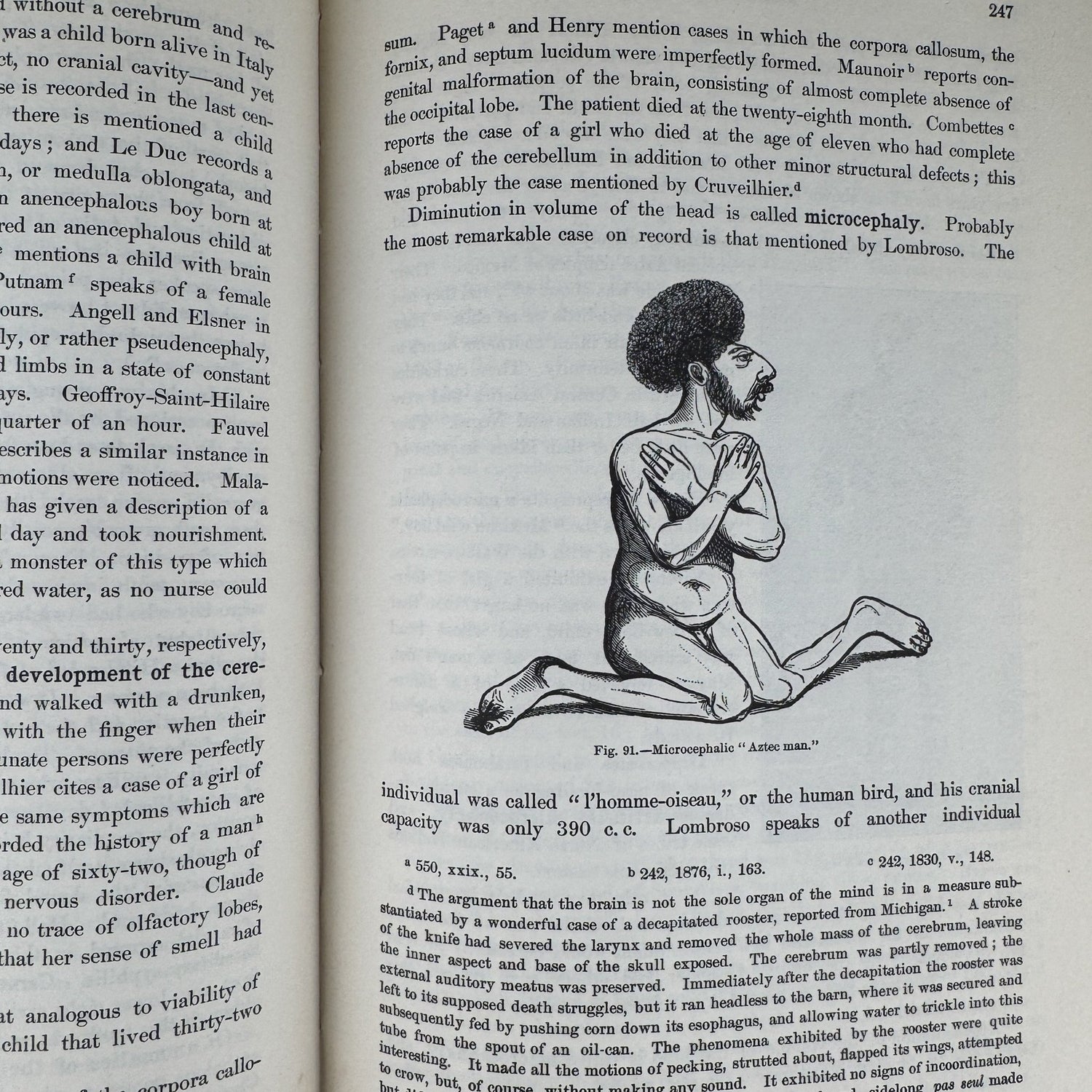 Anomalies and Curiosities of Medicine, 1956, Illustrated - Pretty Old Books