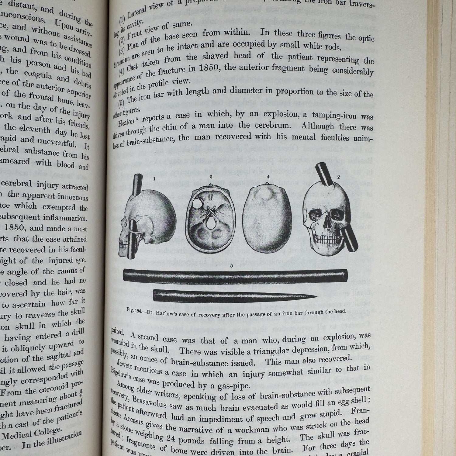 Anomalies and Curiosities of Medicine, 1956, Illustrated - Pretty Old Books