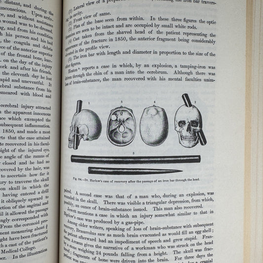 Anomalies and Curiosities of Medicine, 1956, Illustrated - Pretty Old Books