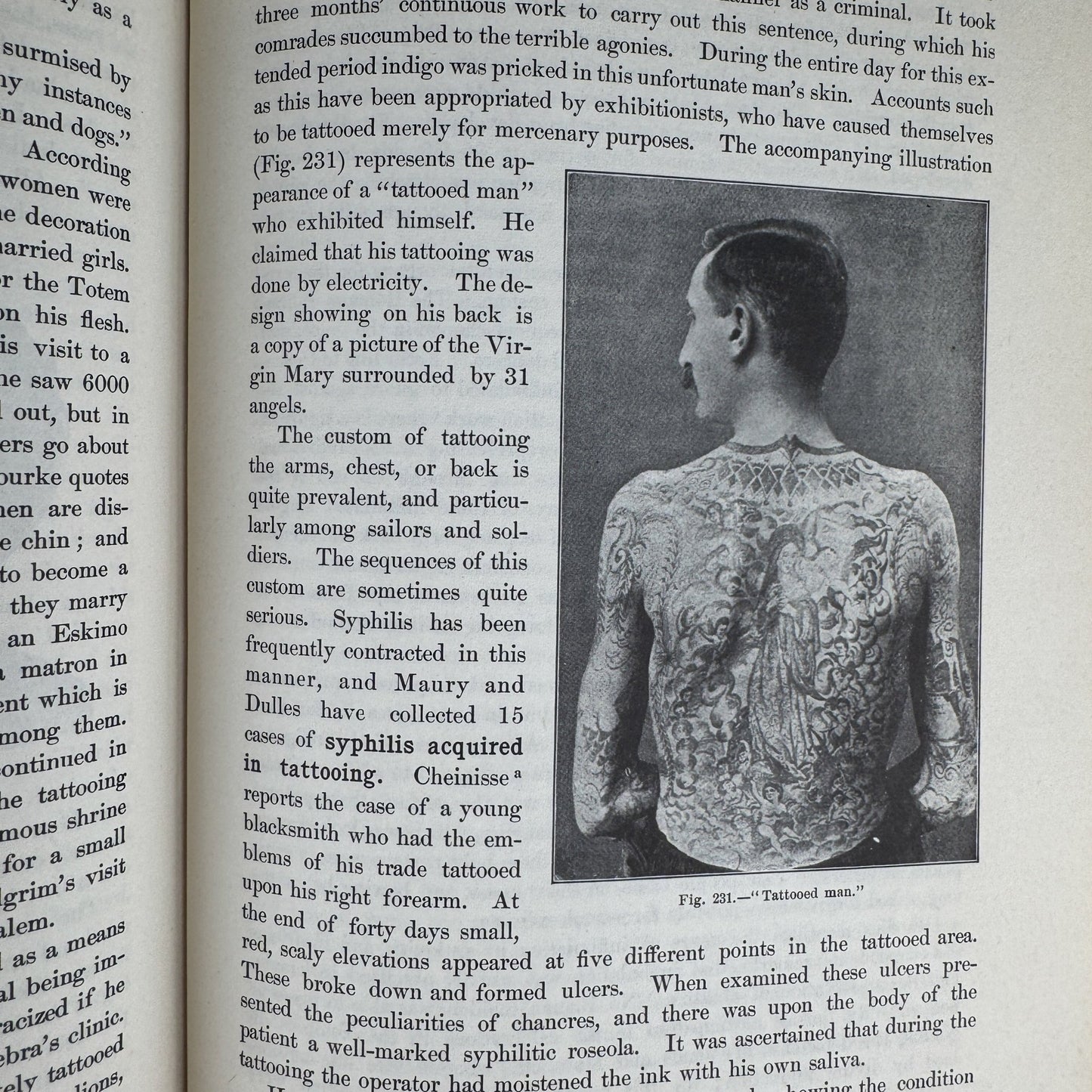 Anomalies and Curiosities of Medicine, 1956, Illustrated - Pretty Old Books