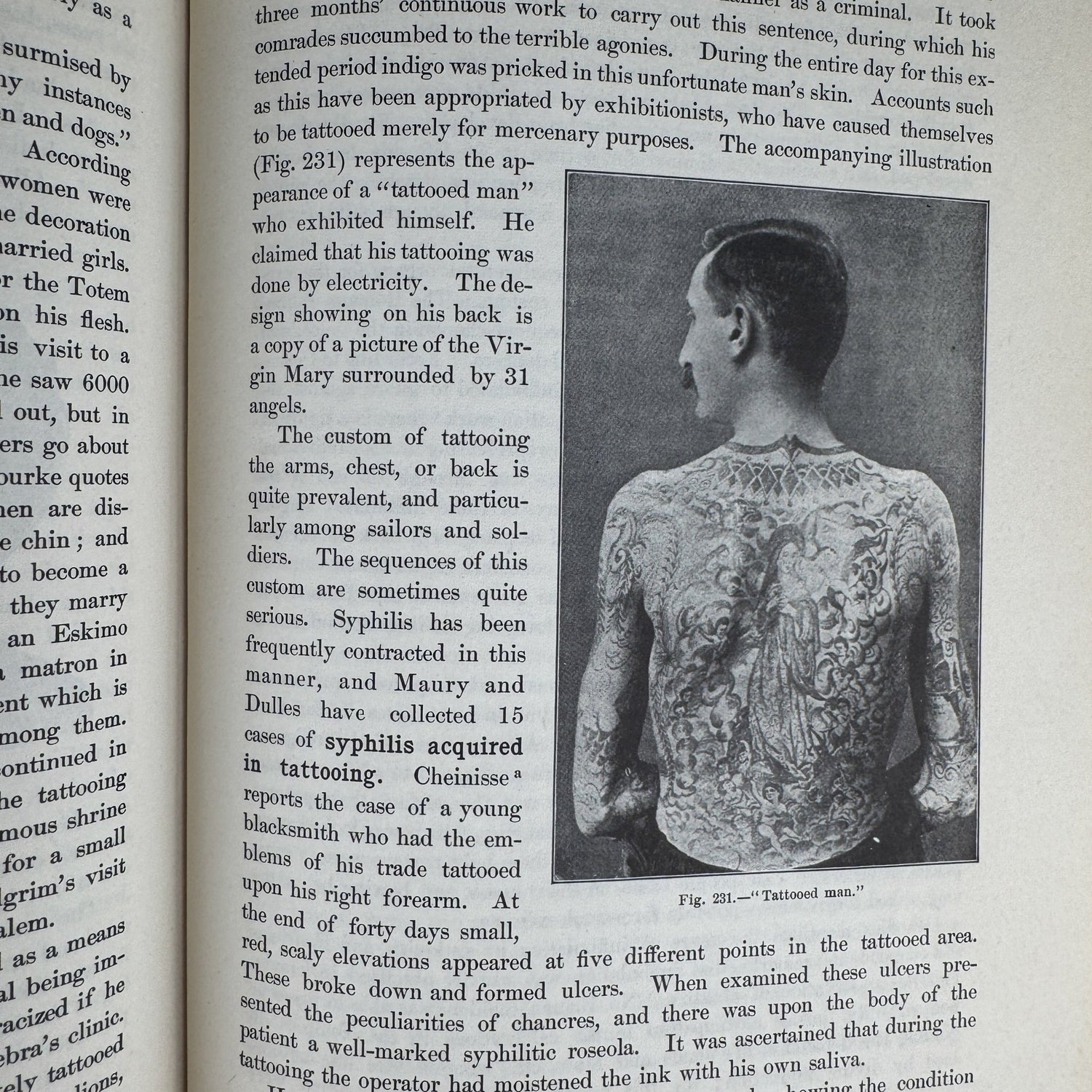 Anomalies and Curiosities of Medicine, 1956, Illustrated - Pretty Old Books