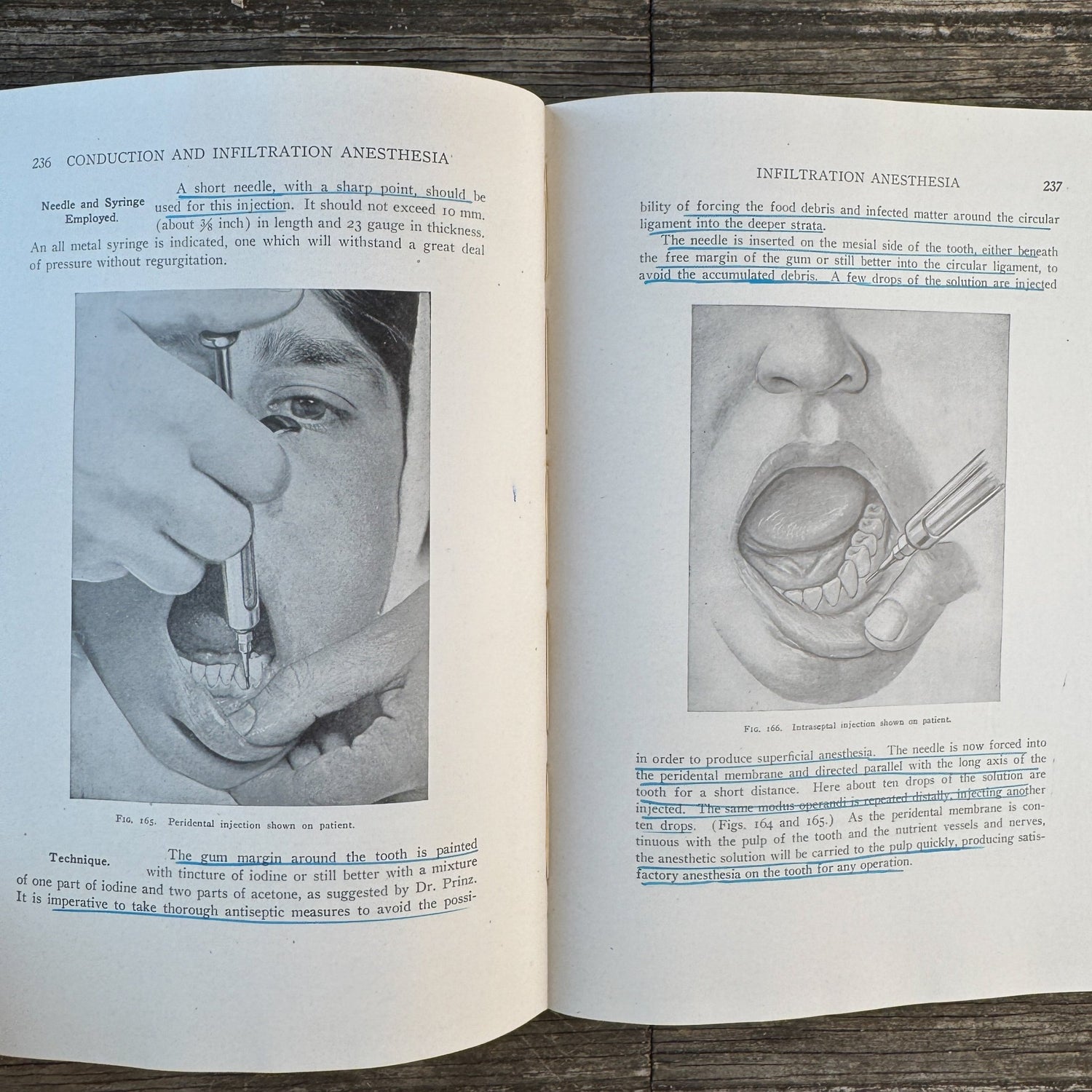 Conduction, Infiltration and General Anesthesia in Dentistry, With Color Anatomy Poster - Pretty Old Books