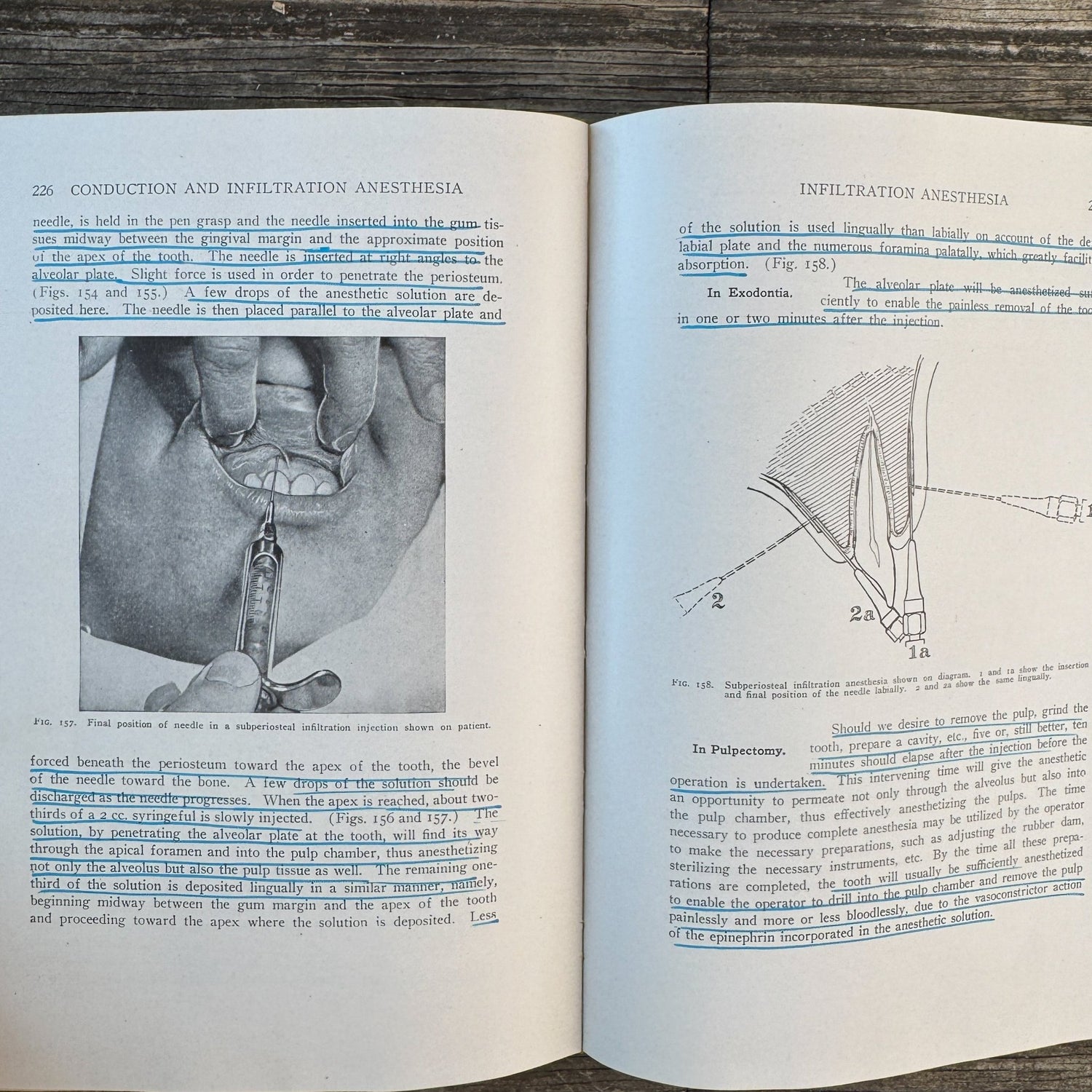 Conduction, Infiltration and General Anesthesia in Dentistry, With Color Anatomy Poster - Pretty Old Books