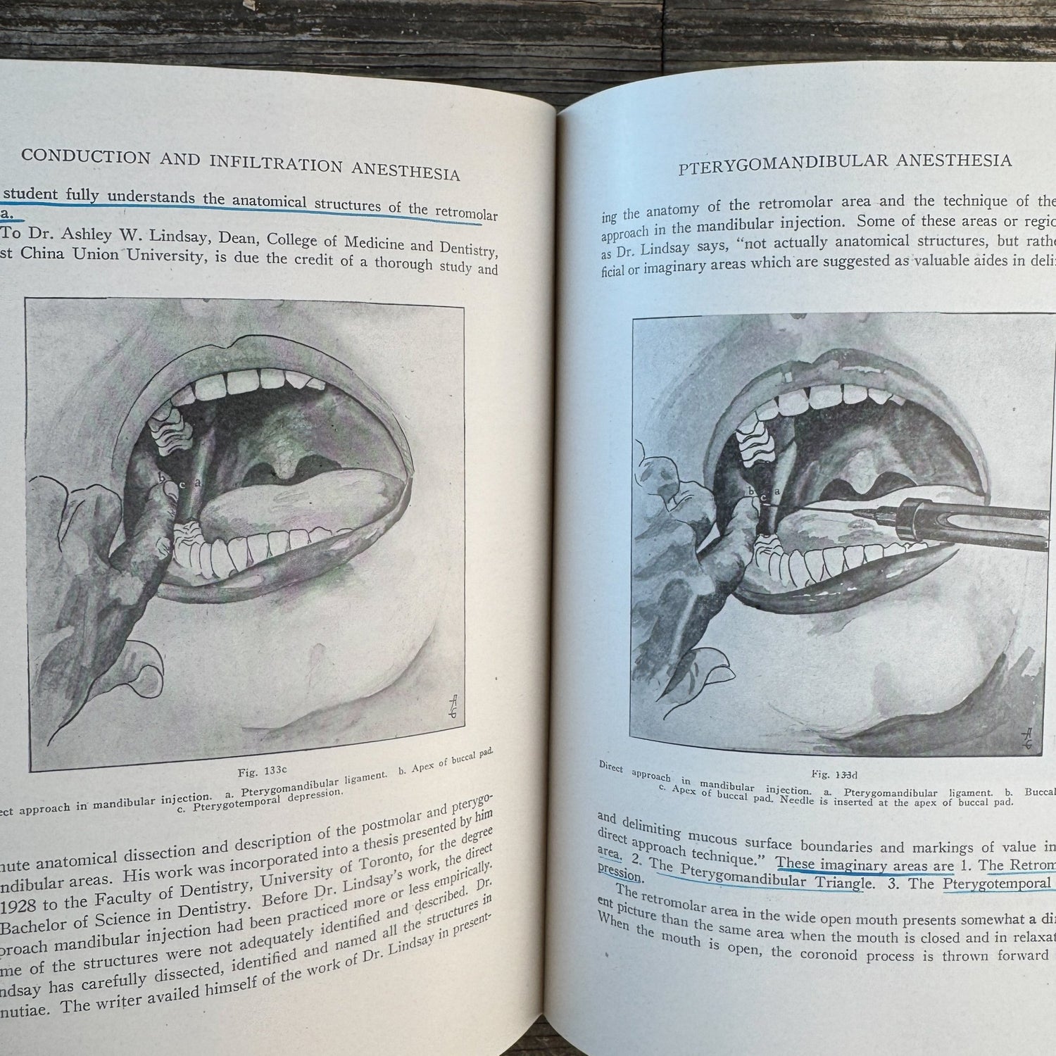 Conduction, Infiltration and General Anesthesia in Dentistry, With Color Anatomy Poster - Pretty Old Books