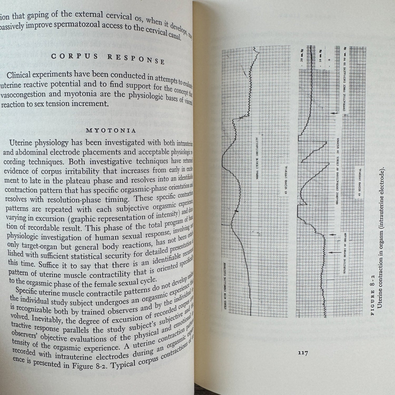 Human Sexual Response, Masters and Johnson First Edition - Pretty Old Books