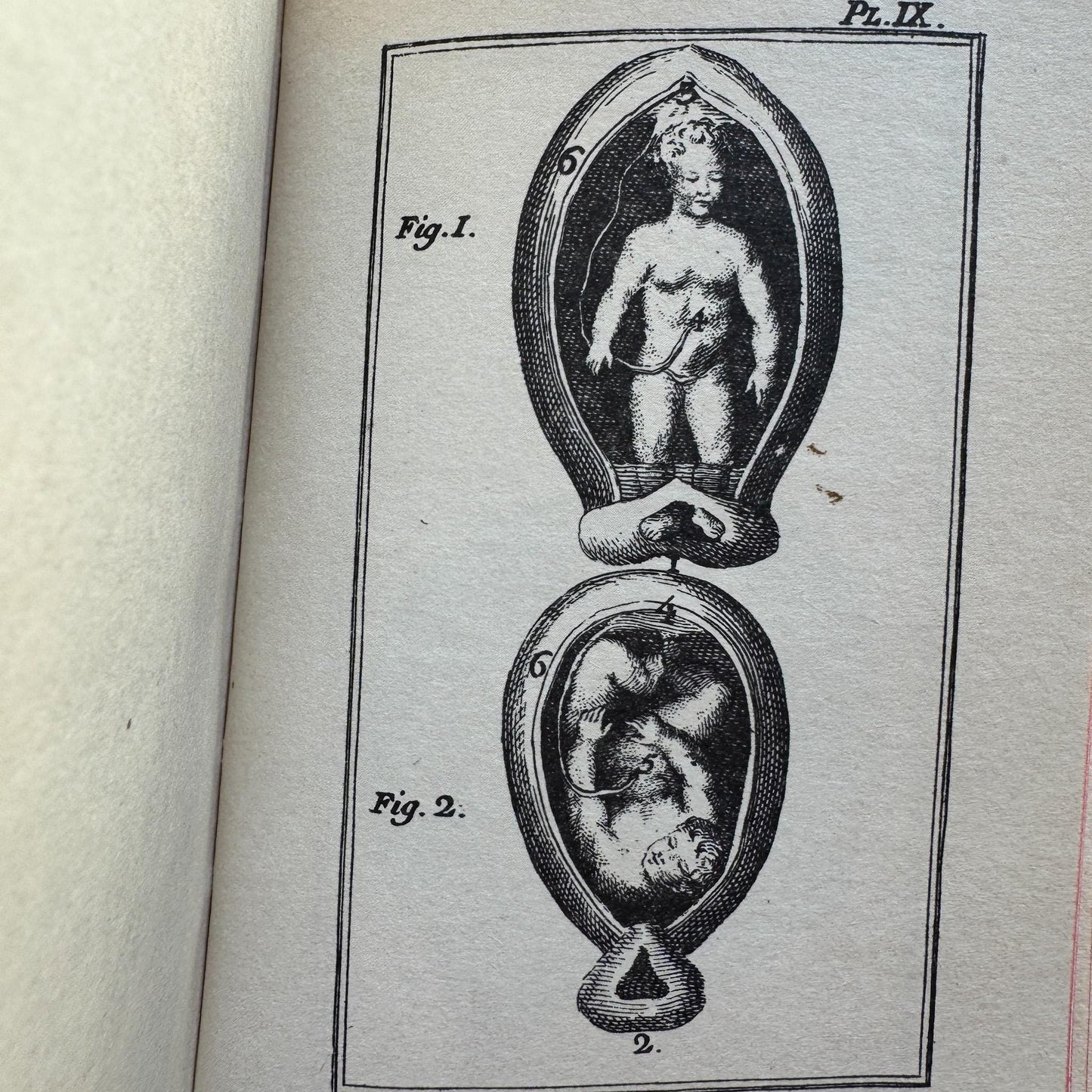 Vintage Reprint of 18th-Century French Marriage and Sex Book Set, De l'Homme et de la Femme, 1772