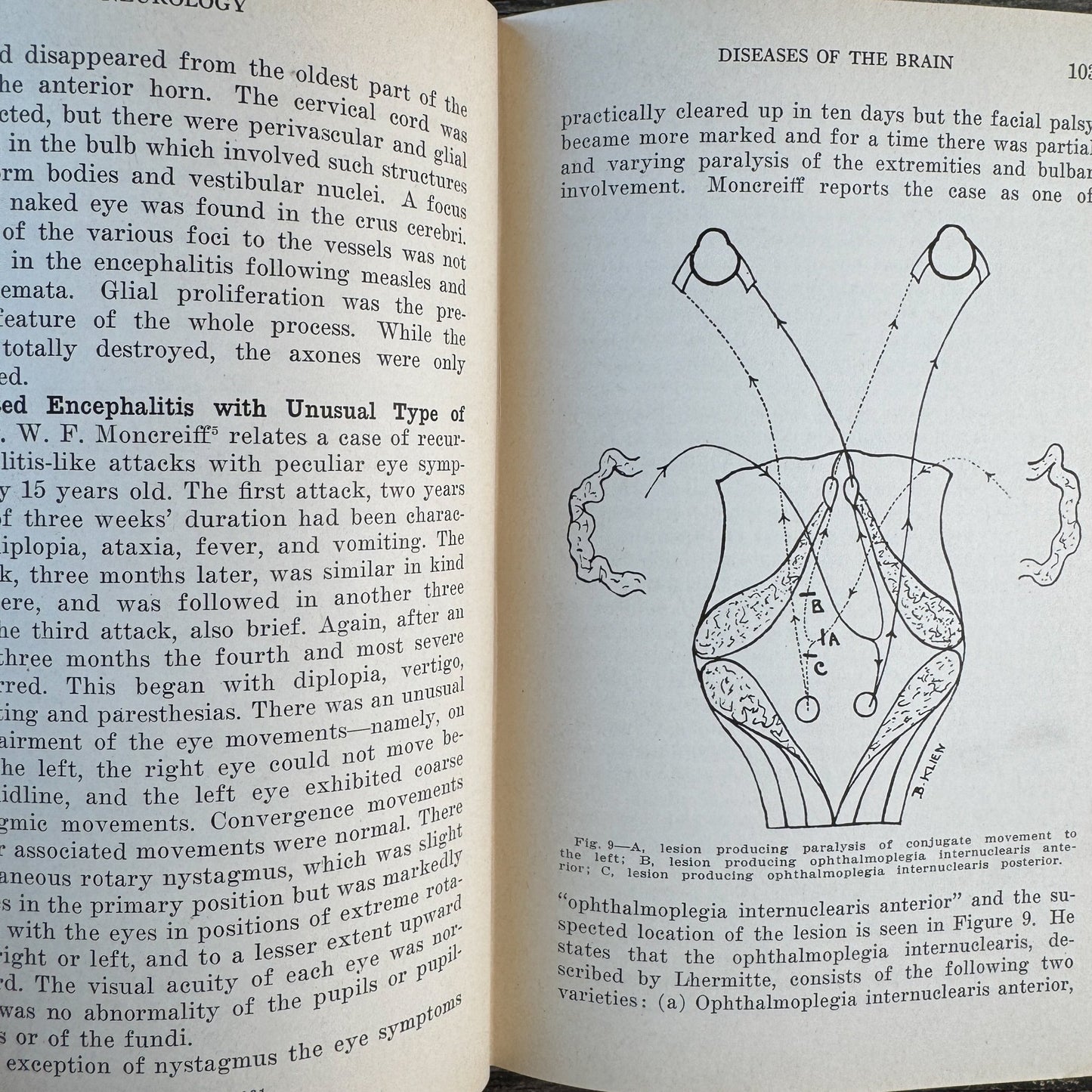 The Practical Medicine Series: Neurology and Psychology, 1931 - Pretty Old Books