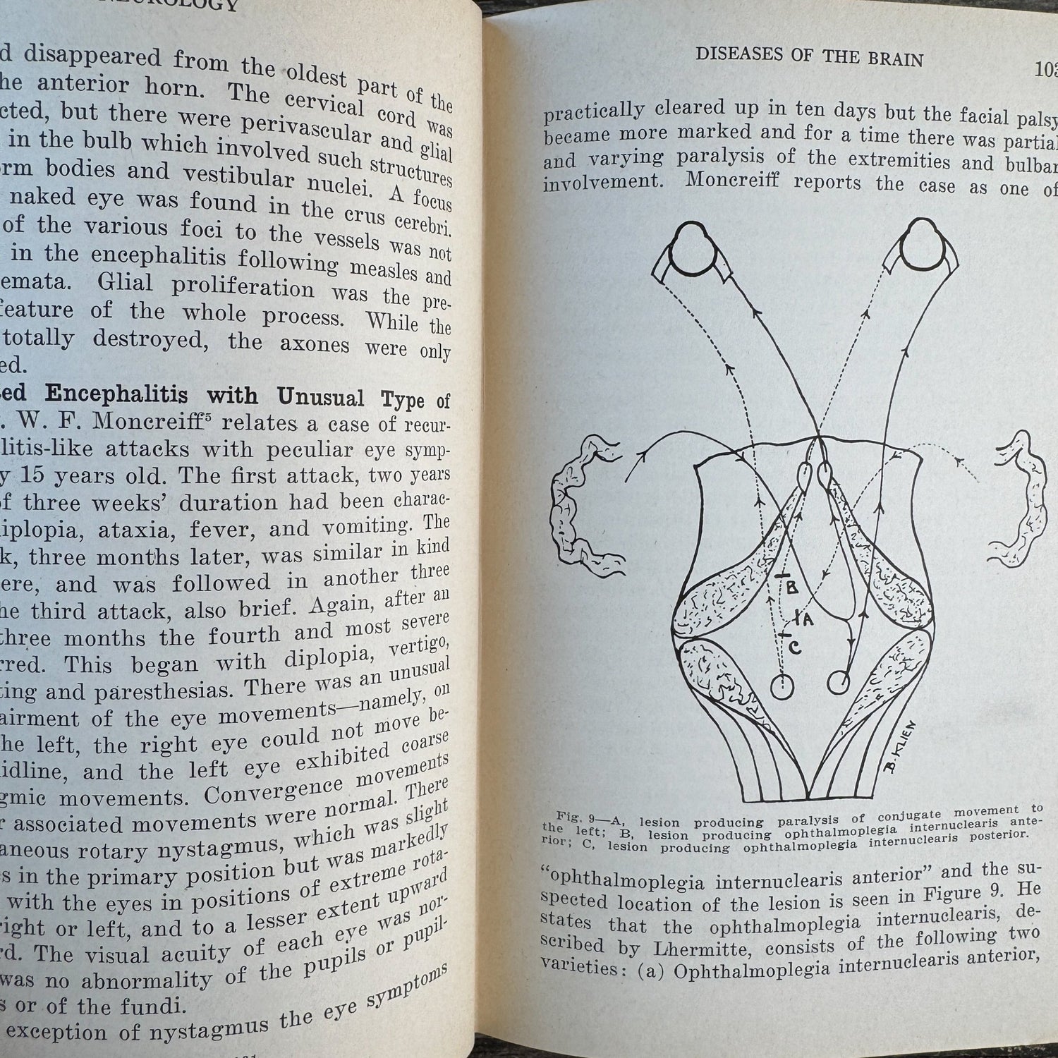 The Practical Medicine Series: Neurology and Psychology, 1931 - Pretty Old Books