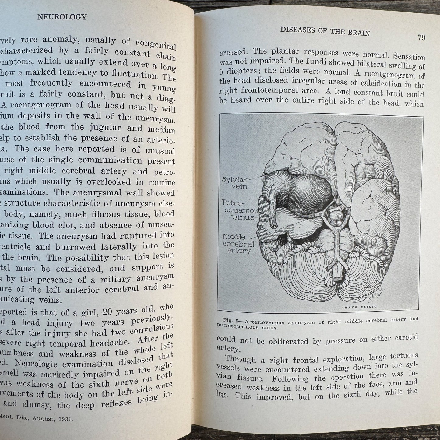The Practical Medicine Series: Neurology and Psychology, 1931 - Pretty Old Books