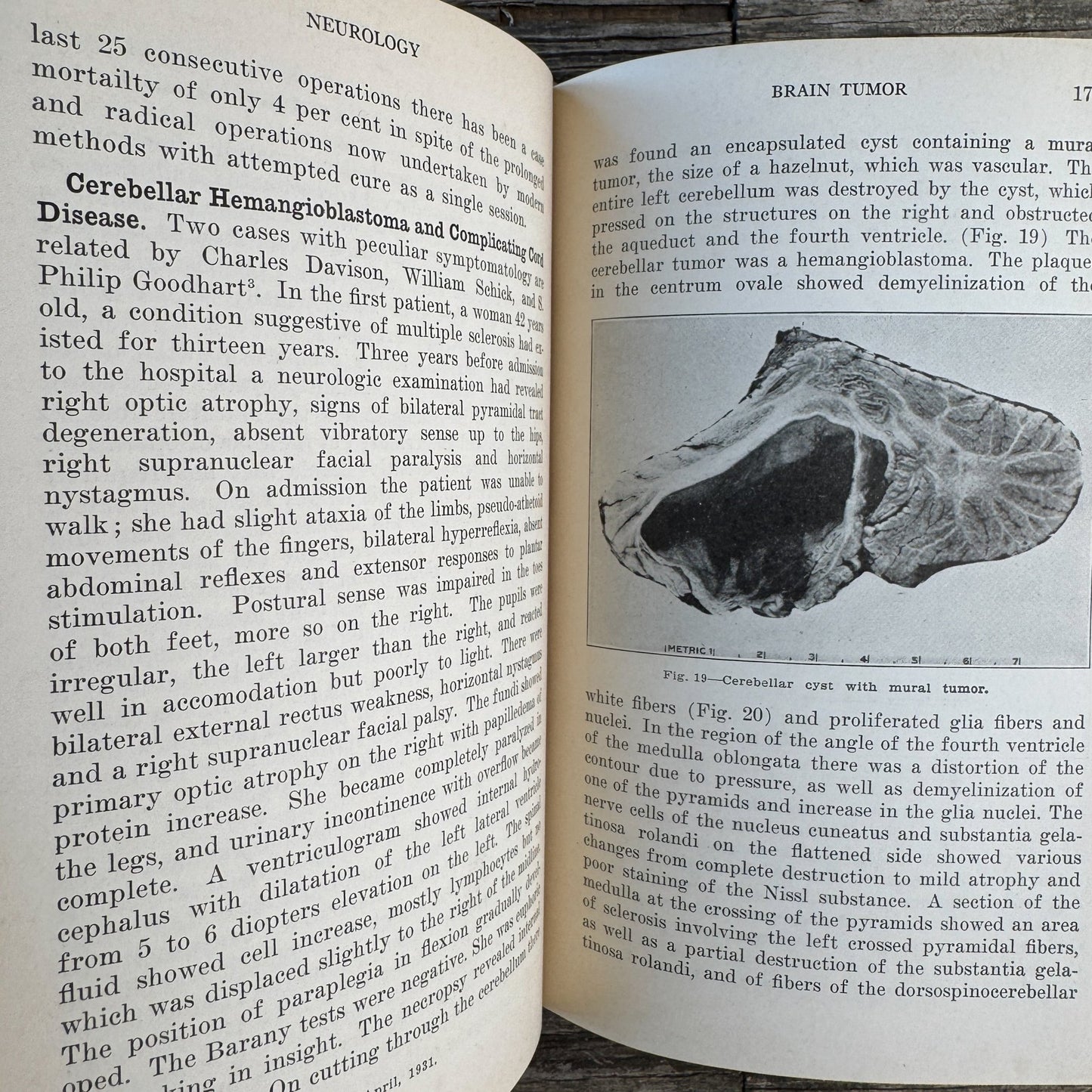 The Practical Medicine Series: Neurology and Psychology, 1931 - Pretty Old Books